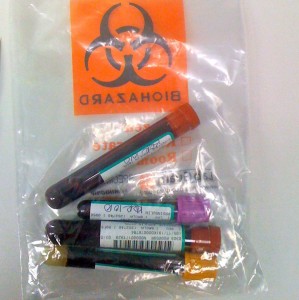 Blood Vials from today's Blood Draw