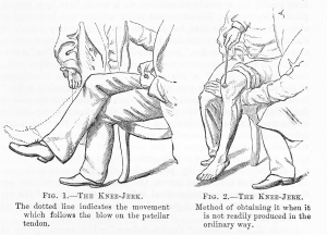 'Knee_Jerk'_from_W_R_Gowers'_Manual_of_Diseases_of_the_Nervous_System_1886